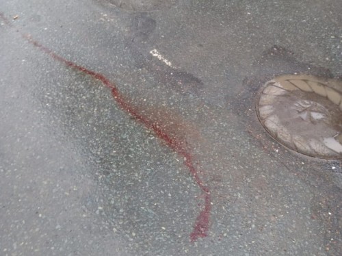 В Оренбурге на улице Чичерина мужчине отстрели нос