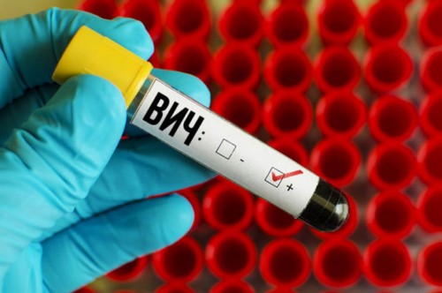 Оренбурженка за заражение ВИЧ хочет взыскать 2 000 000 рублей с бывшего мужа Оренбурженка за заражение ВИЧ хочет взыскать 2 000 000 рублей с бывшего мужа